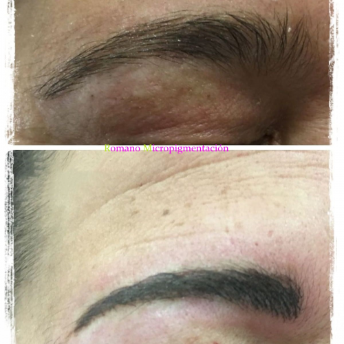 Foto Romano Micropigmentaci�n y Est�tica